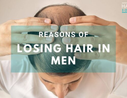Top 7 Reasons of Losing Hair in Men