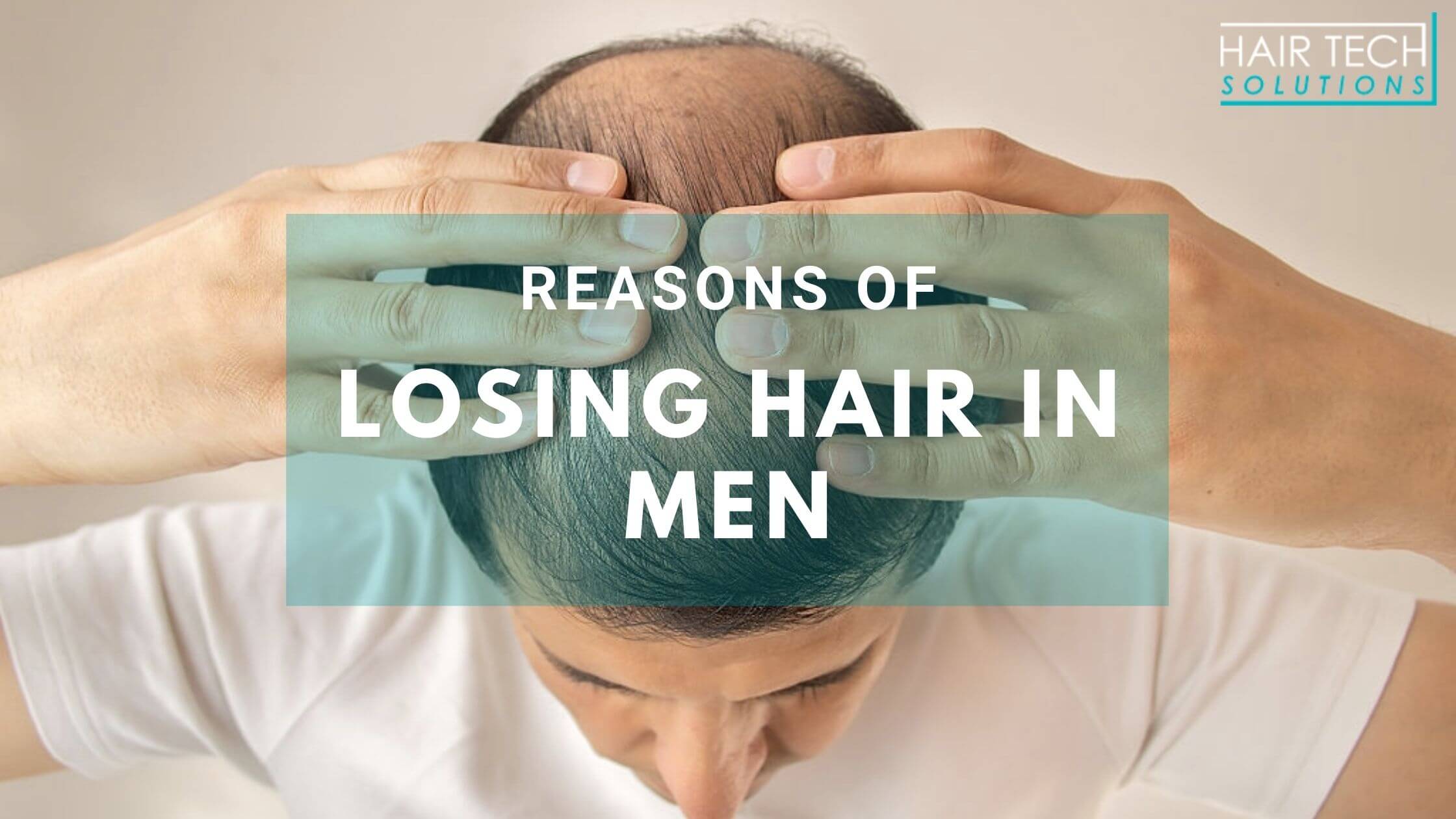 Reasons of Losing Hair in Men