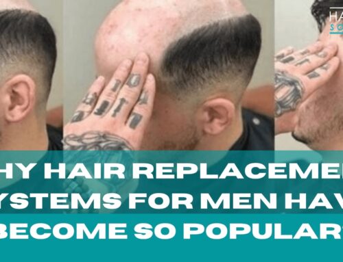 Why Hair Replacement Systems For Men Have Become So Popular?