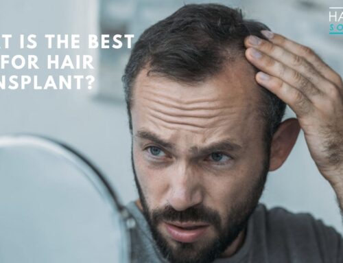 What Is The Best Age For Hair Transplant?